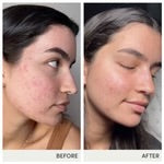 Skin Accumax 14 week Reset