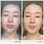 Skin Accumax 14 week Reset