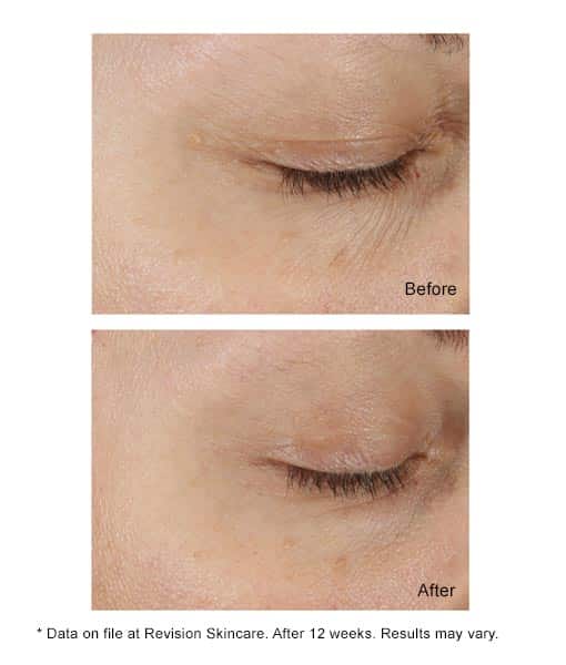 DEJ Eye Cream® 0.25 FL OZ