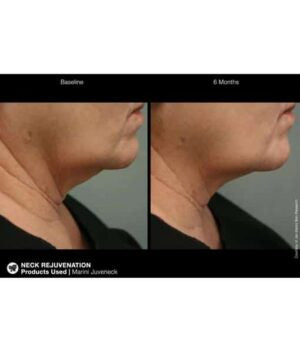Marini Juveneck Neck Cream