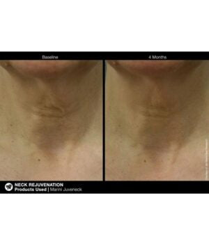 Marini Juveneck Neck Cream