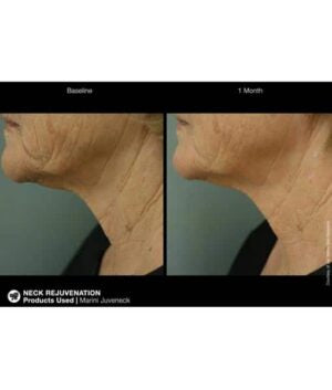 Marini Juveneck Neck Cream
