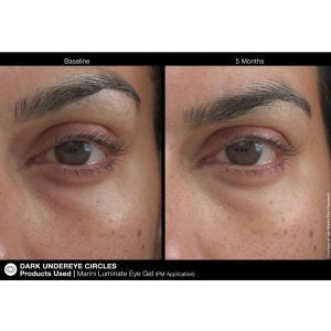 Luminate Eye Gel