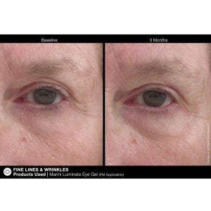 Luminate Eye Gel