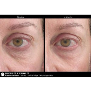 Luminate Eye Gel