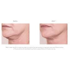 Nectifirm® ADVANCED 0.5 OZ - Neck Cream