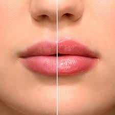 Lip Plumper Sara Happ