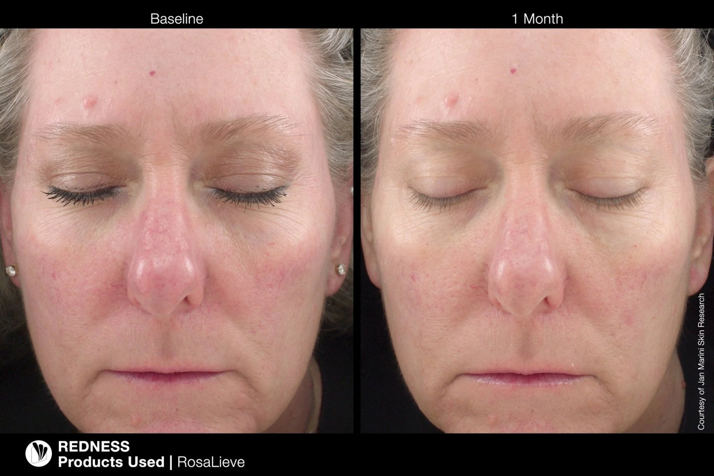 Rosalieve Redness Reducing Comples