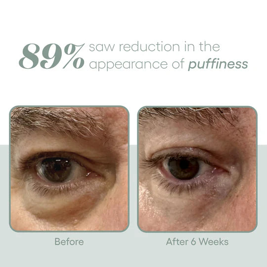 EYE Serum - ( plated )